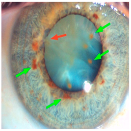 Nutrients 17 02964 i007