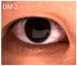 Nutrients 17 02964 i009