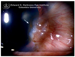 Nutrients 17 02964 i012