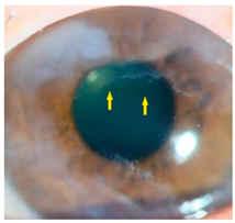 Nutrients 17 02964 i013