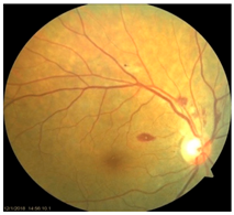 Nutrients 17 02964 i015