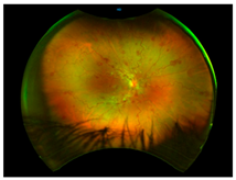 Nutrients 17 02964 i016