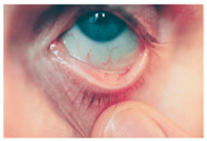 Nutrients 17 02964 i017