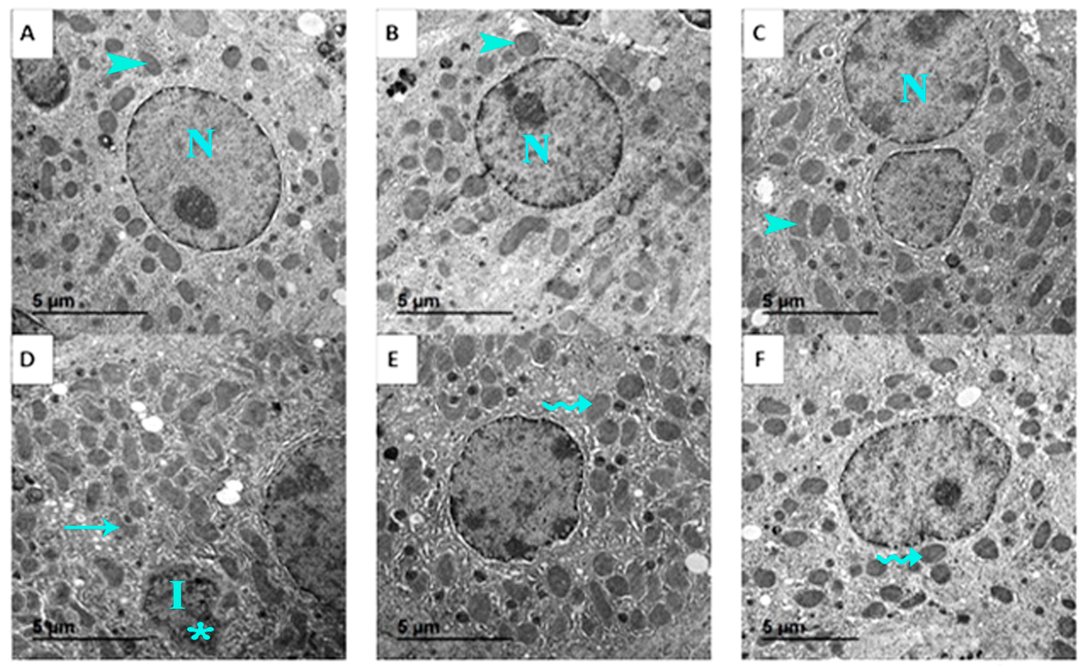Nutrients 17 03450 g013 Nutrients 17 03450 g013