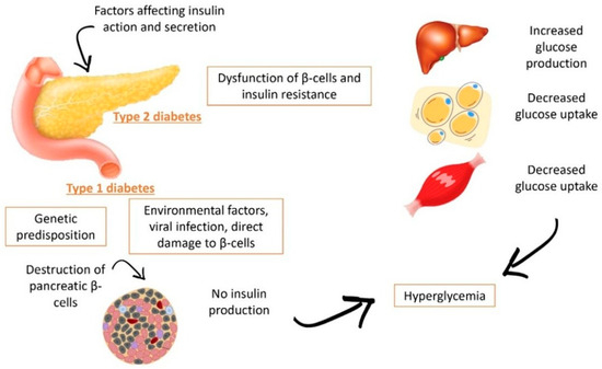 Obesity and Diabetes in Mexico: An Approach to the Intestinal
