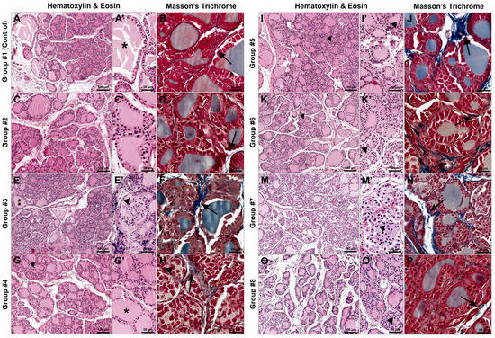 Iodoquinoline-Biofortified Lettuce as a Safe and Bioavailable