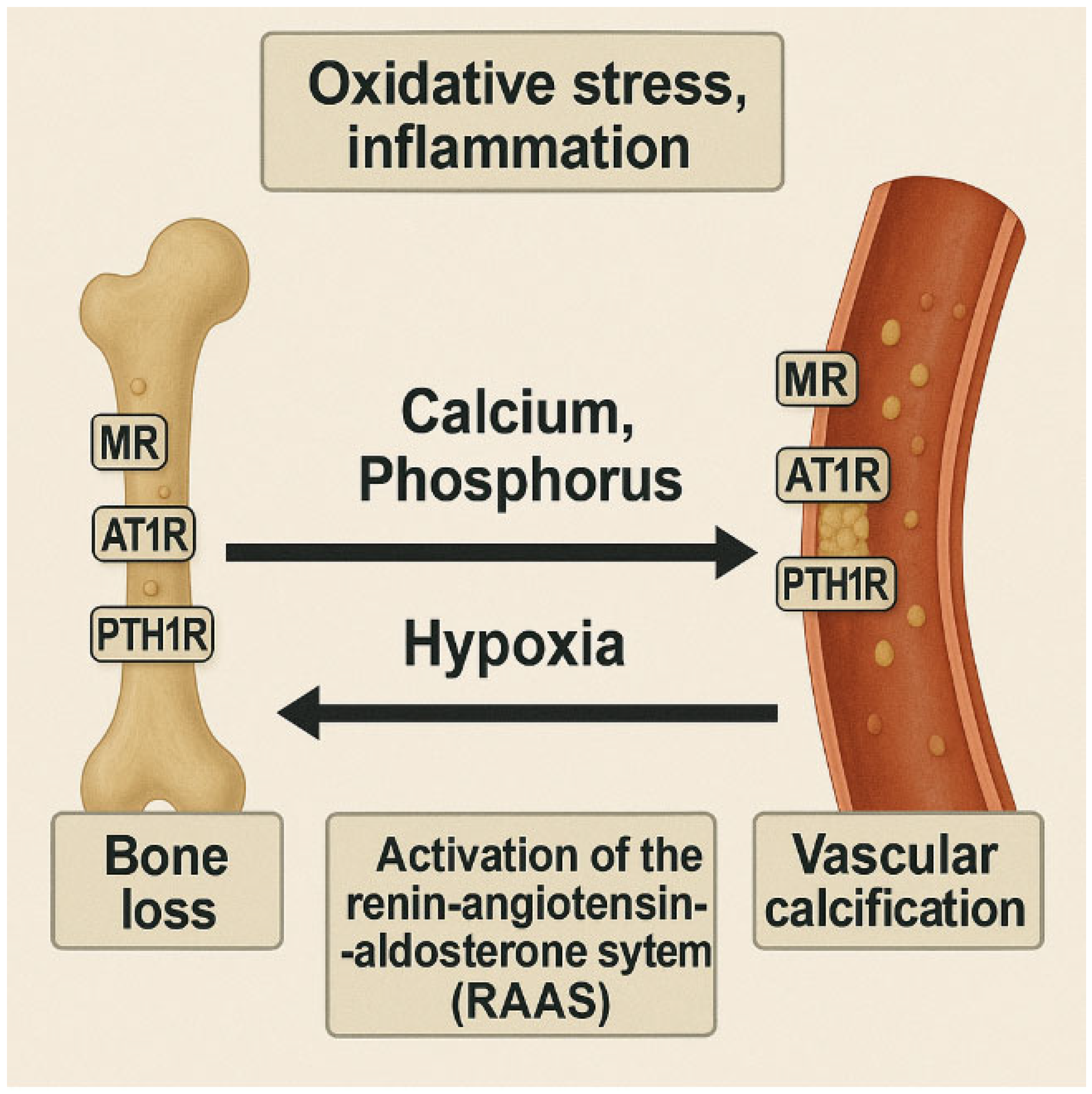 Underlying Mechanisms of Osteoporosis in the Context of