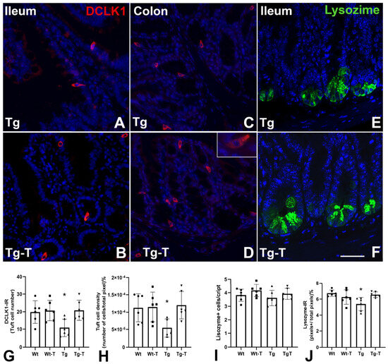 The Multiple Functions of Amyloid Beta in the Gut Epithelium and