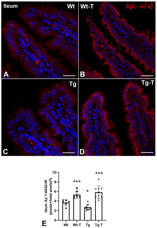 The Multiple Functions of Amyloid Beta in the Gut Epithelium and