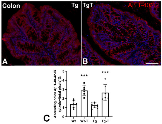 The Multiple Functions of Amyloid Beta in the Gut Epithelium and
