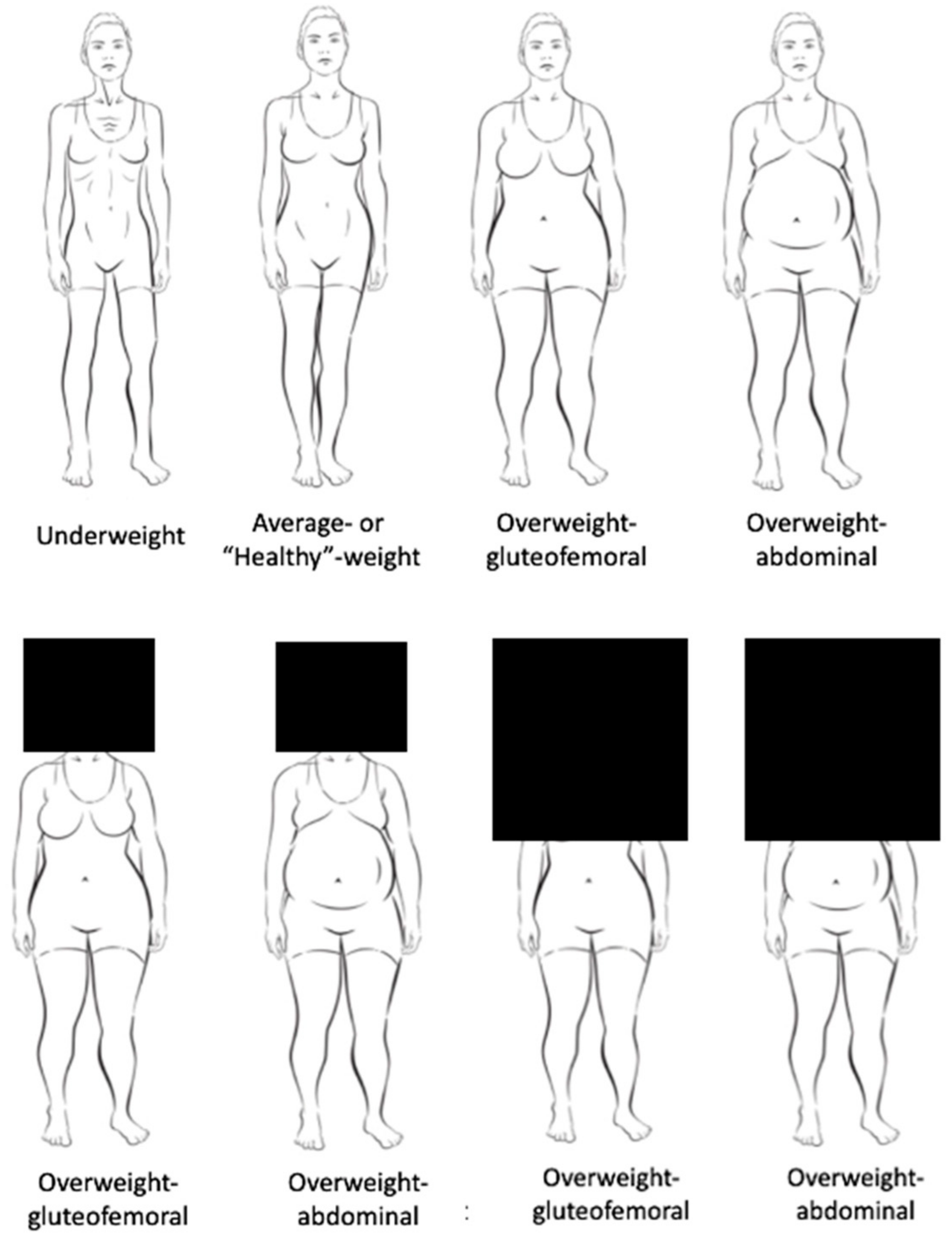 Obesities Free Full-Text The Role of Womenandrsquo;s and Menandrsquo;s Body Shapes in Explicit and Implicit Fat Stigma image
