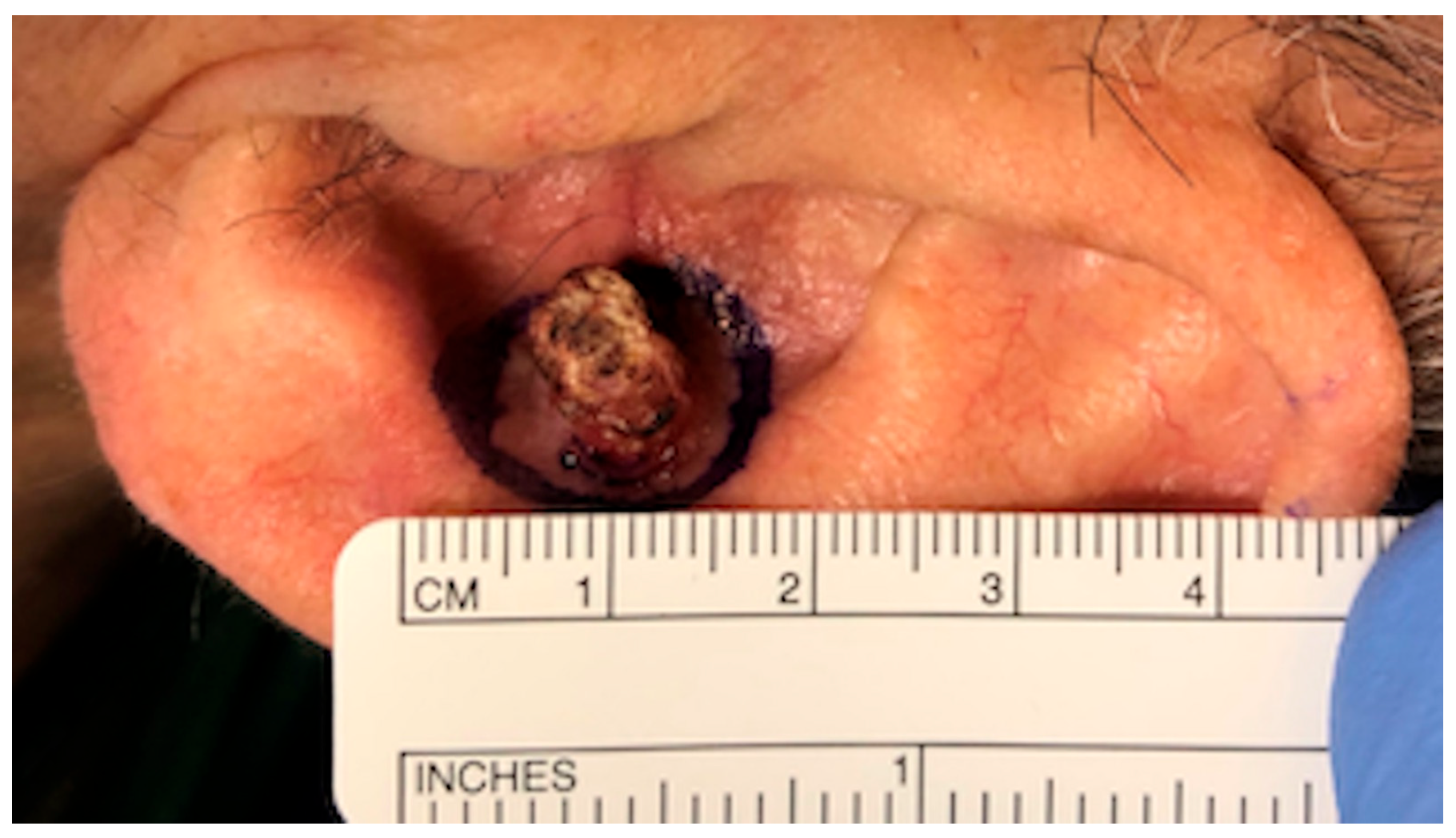 Ohbm 04 00010 g001 Ohbm 04 00010 g001