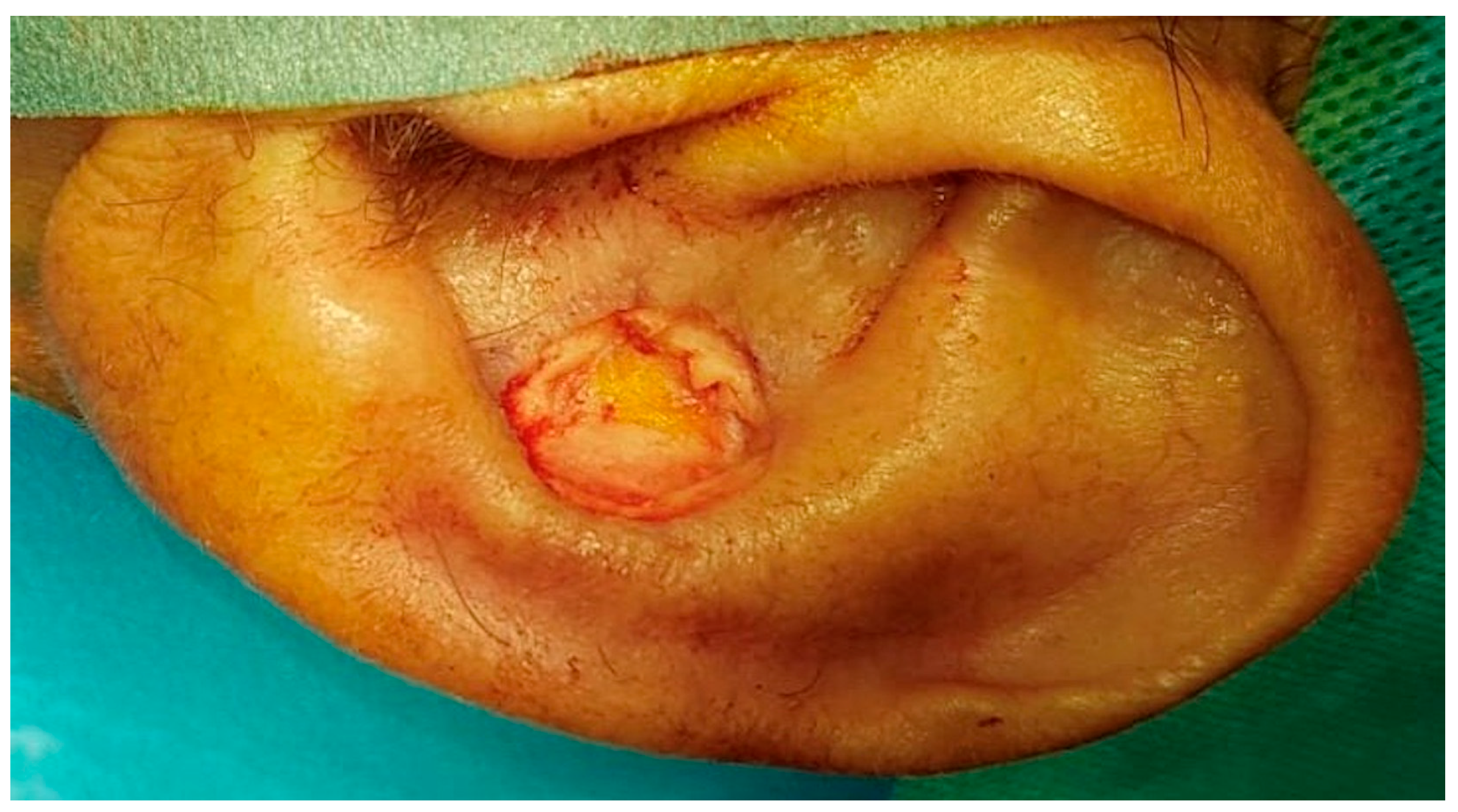 Ohbm 04 00010 g002 Ohbm 04 00010 g002