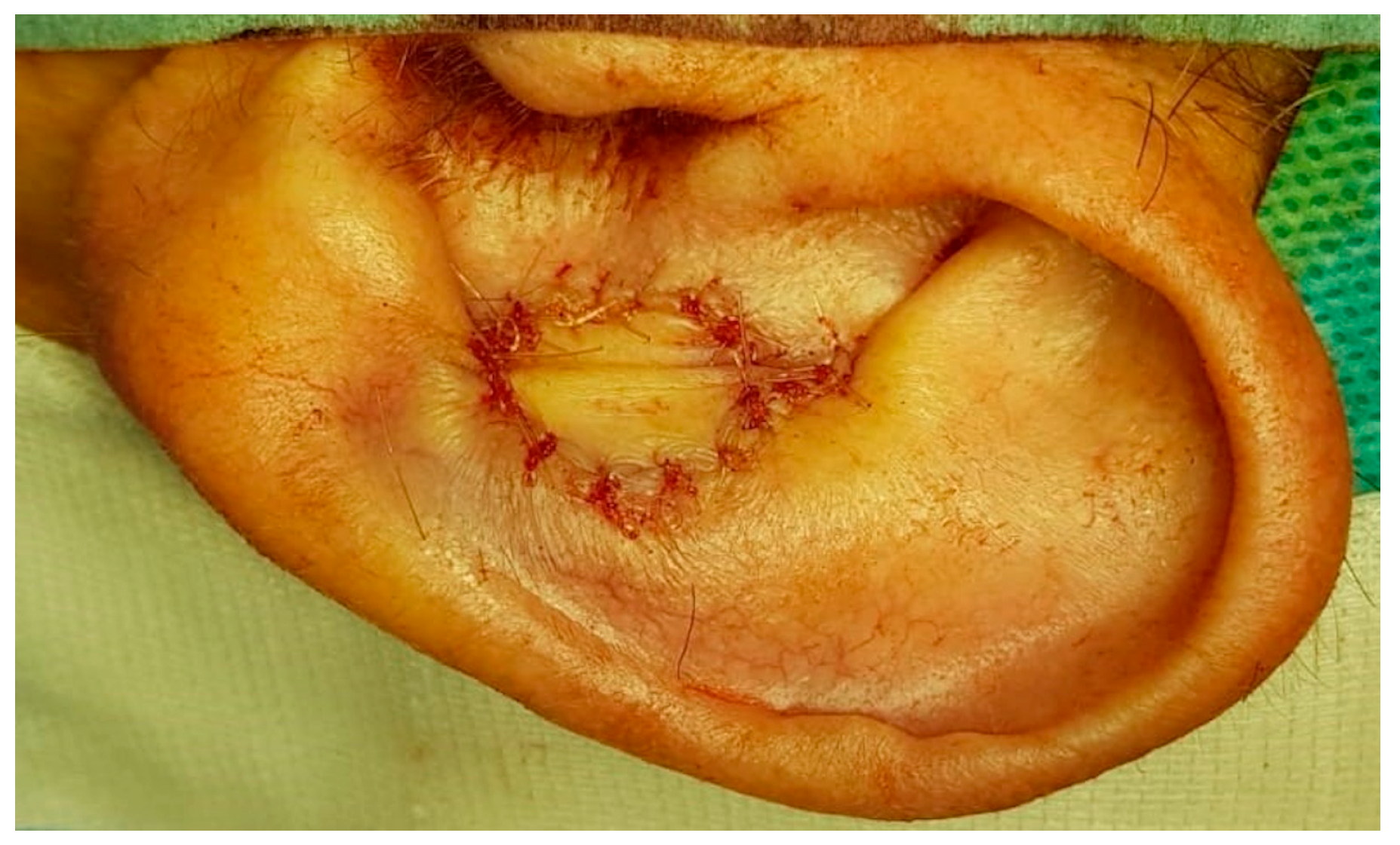 Ohbm 04 00010 g005 Ohbm 04 00010 g005