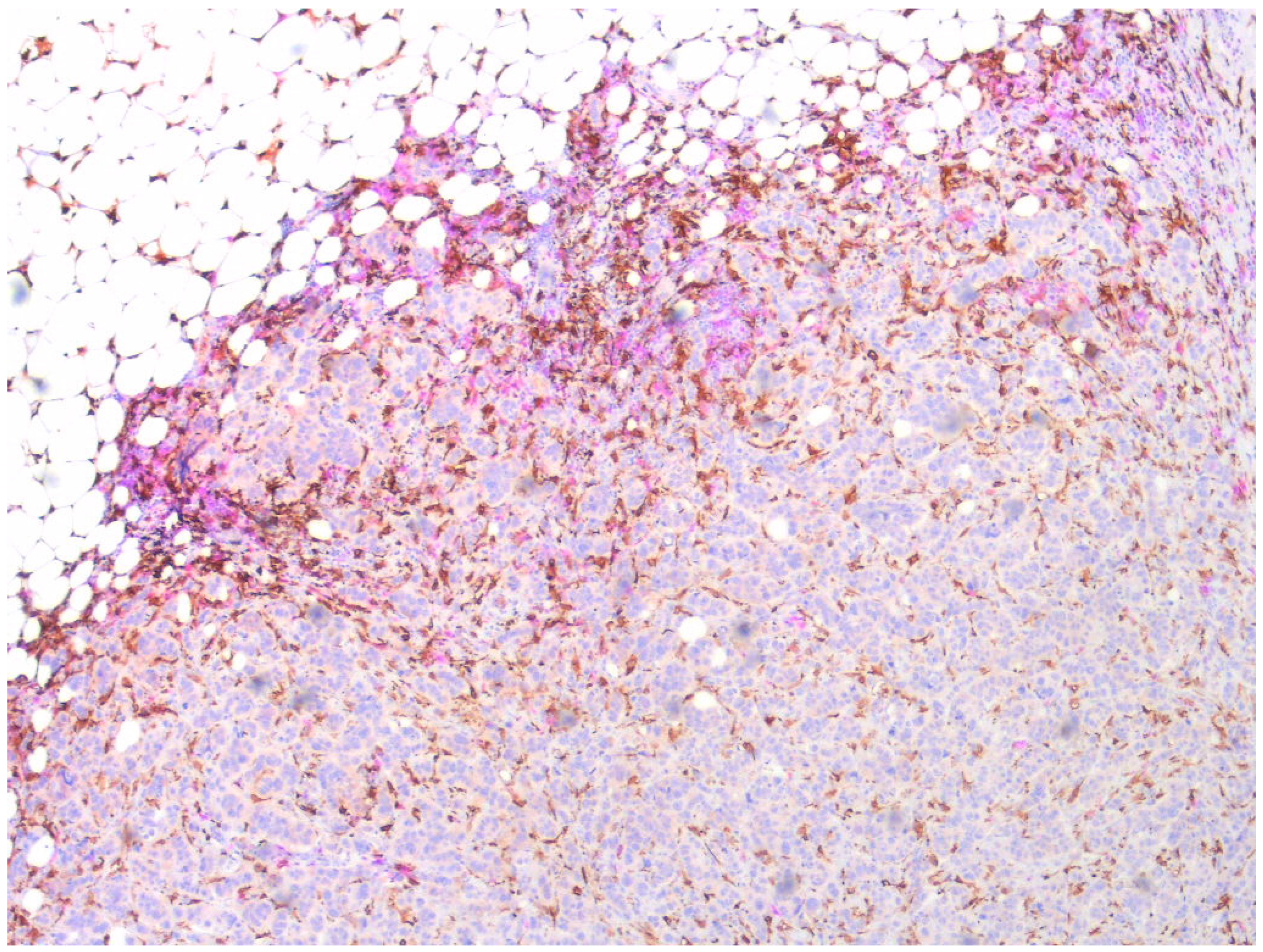 Onco 02 00001 g002 550