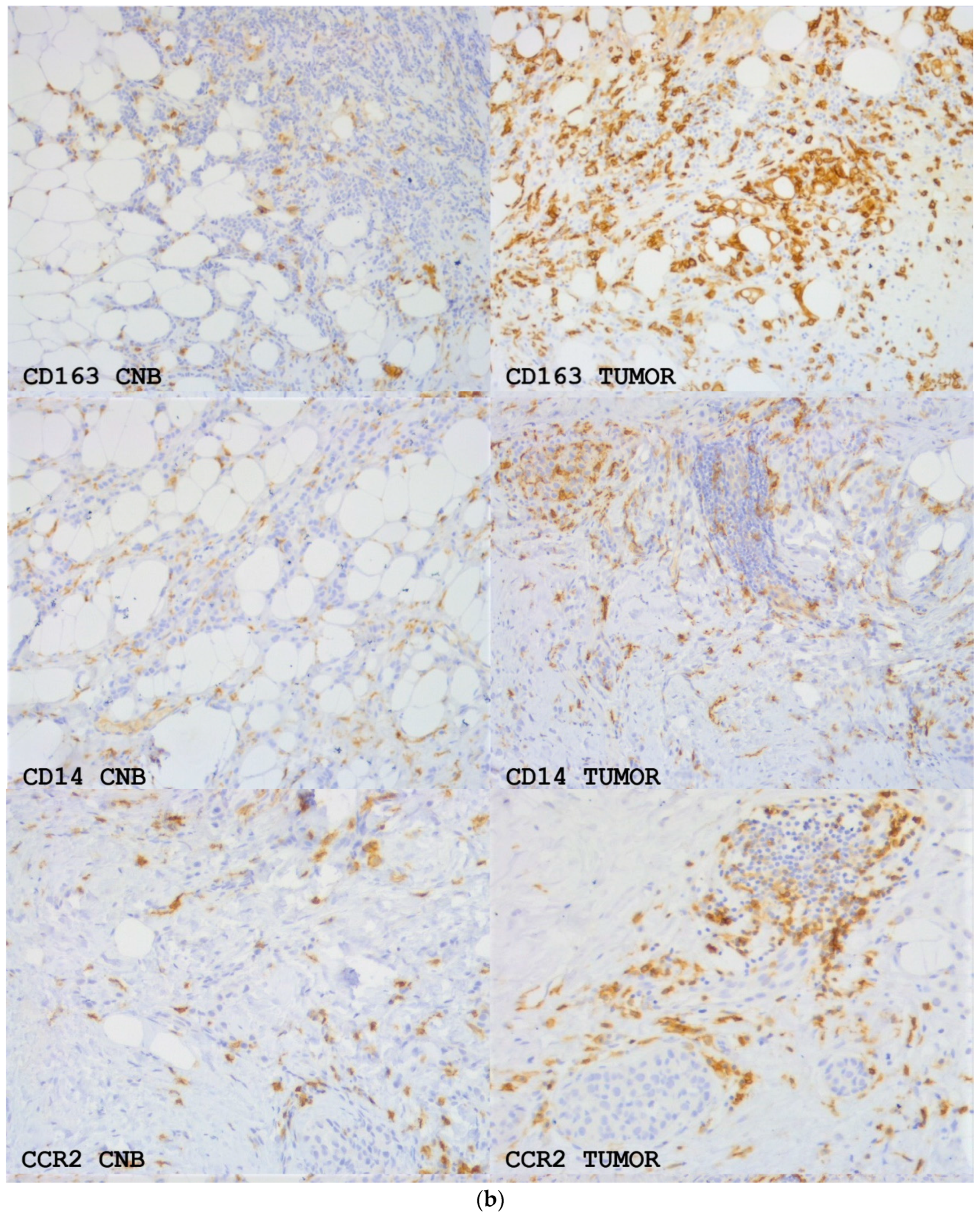 Onco 02 00001 g004b 550