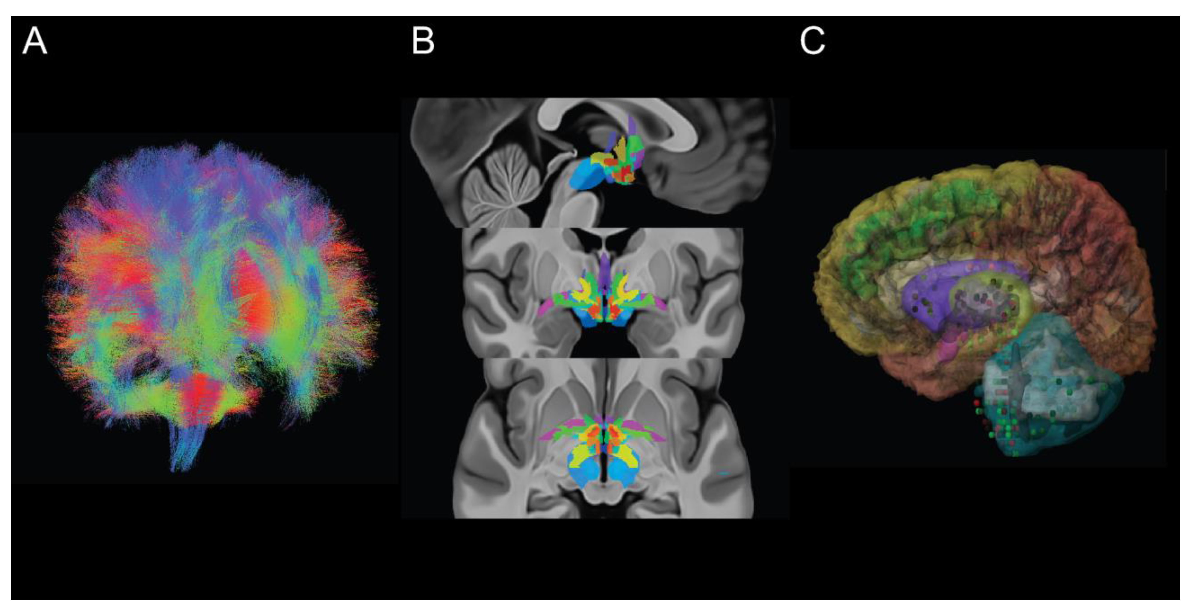 BigBrain: An Ultrahigh-Resolution 3D Human Brain Model