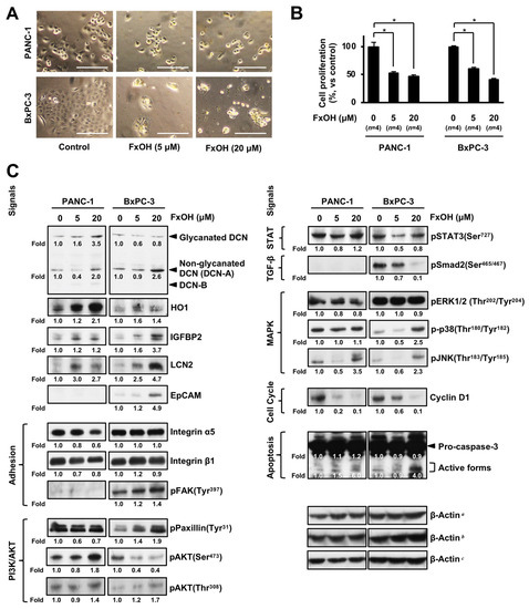 Anticancer Effects of Fucoxanthin in a PDX Model of Advanced