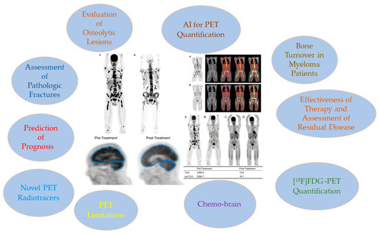 Significance of PET/CT Imaging in Myeloma Assessment: Exploring 