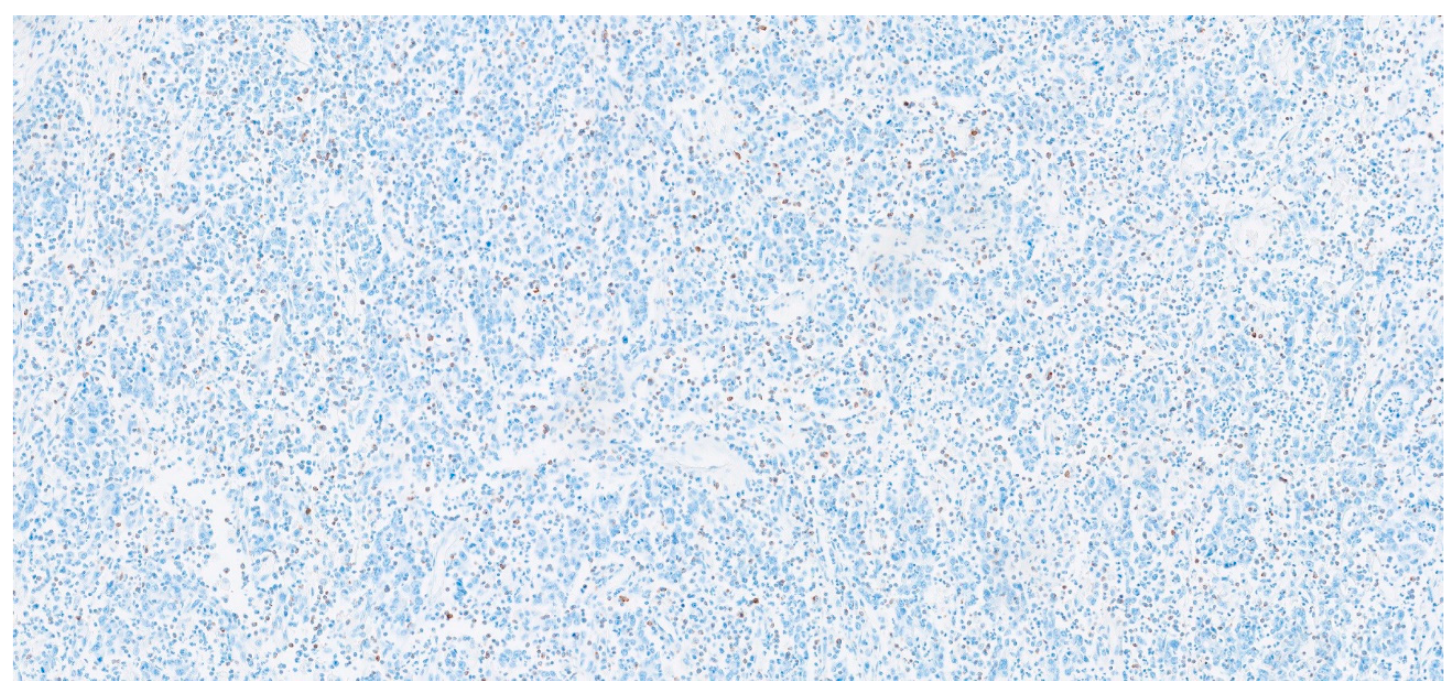 Onco 04 00010 g003 Onco 04 00010 g003