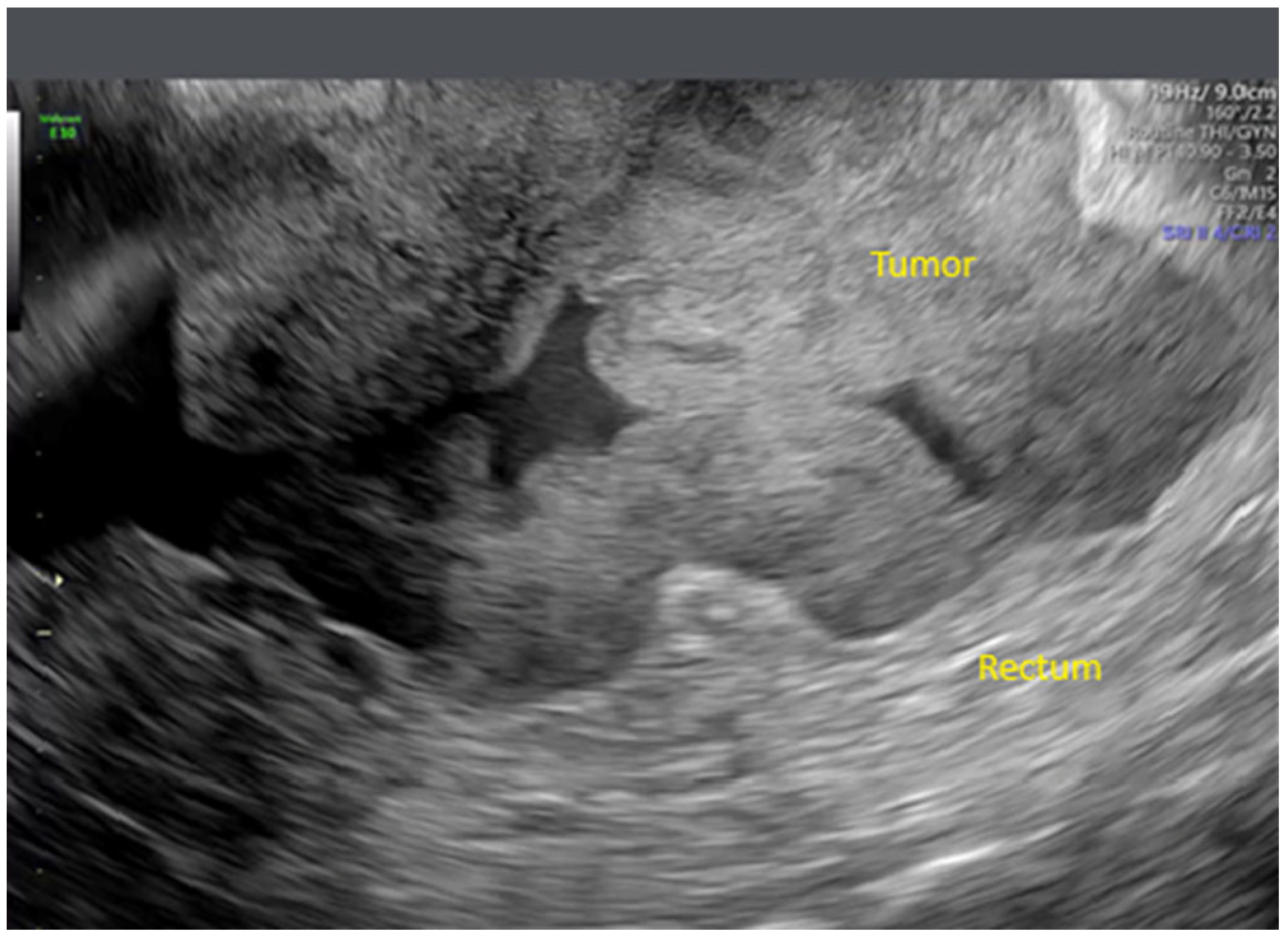 Onco 05 00046 g002 Onco 05 00046 g002