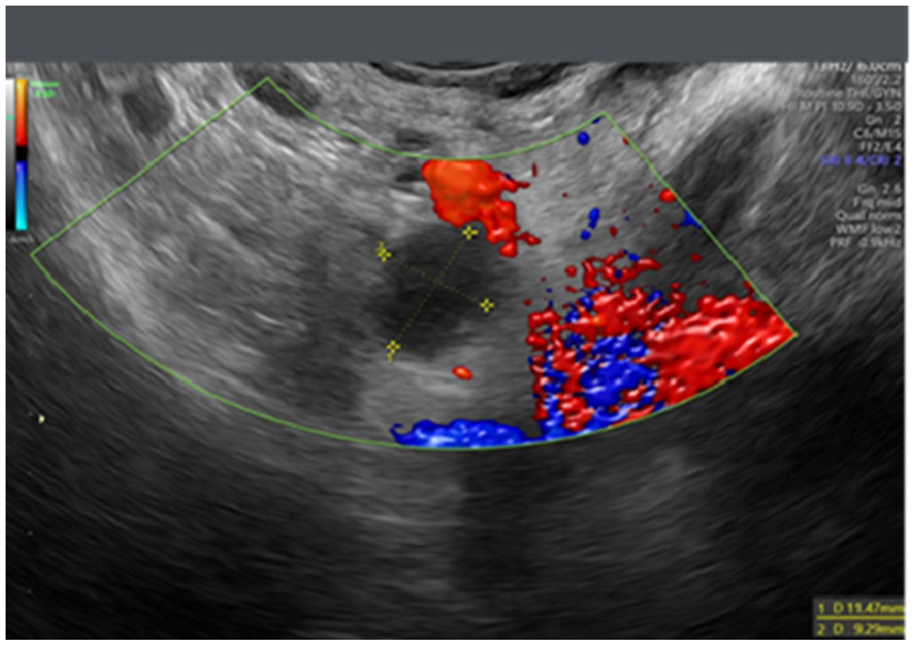 Onco 05 00046 g003 Onco 05 00046 g003