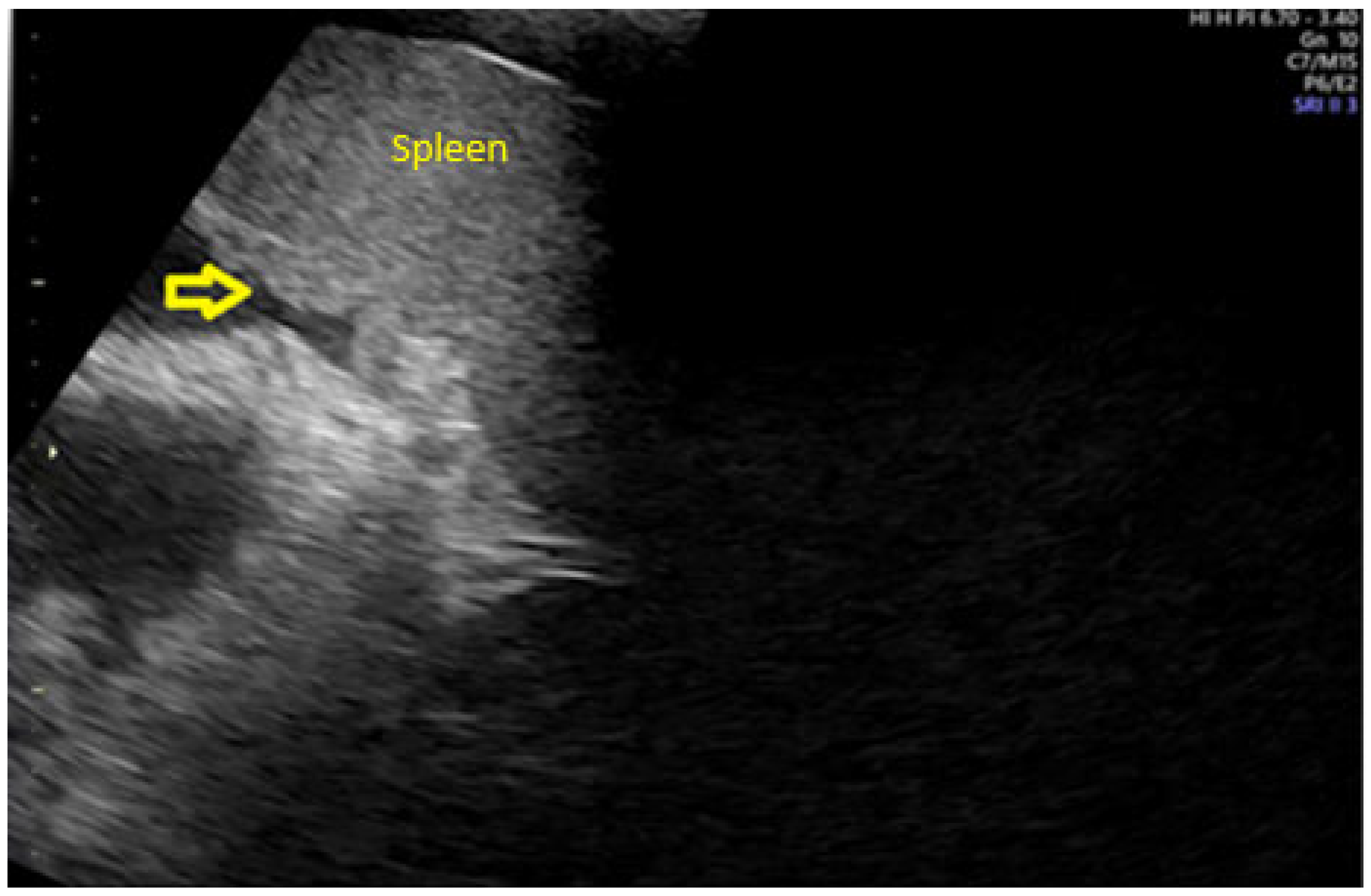 Onco 05 00046 g004 Onco 05 00046 g004