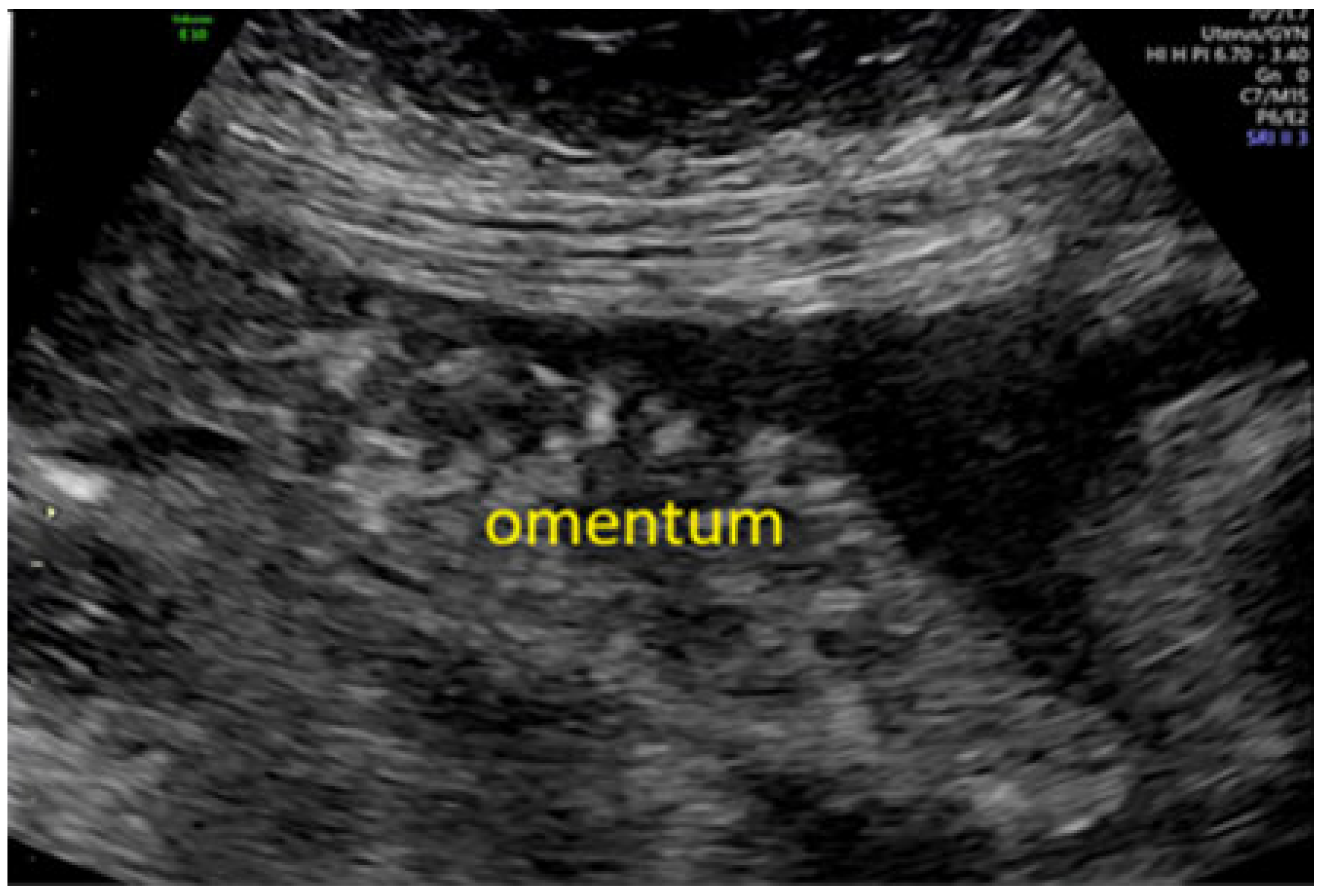 Onco 05 00046 g005 Onco 05 00046 g005