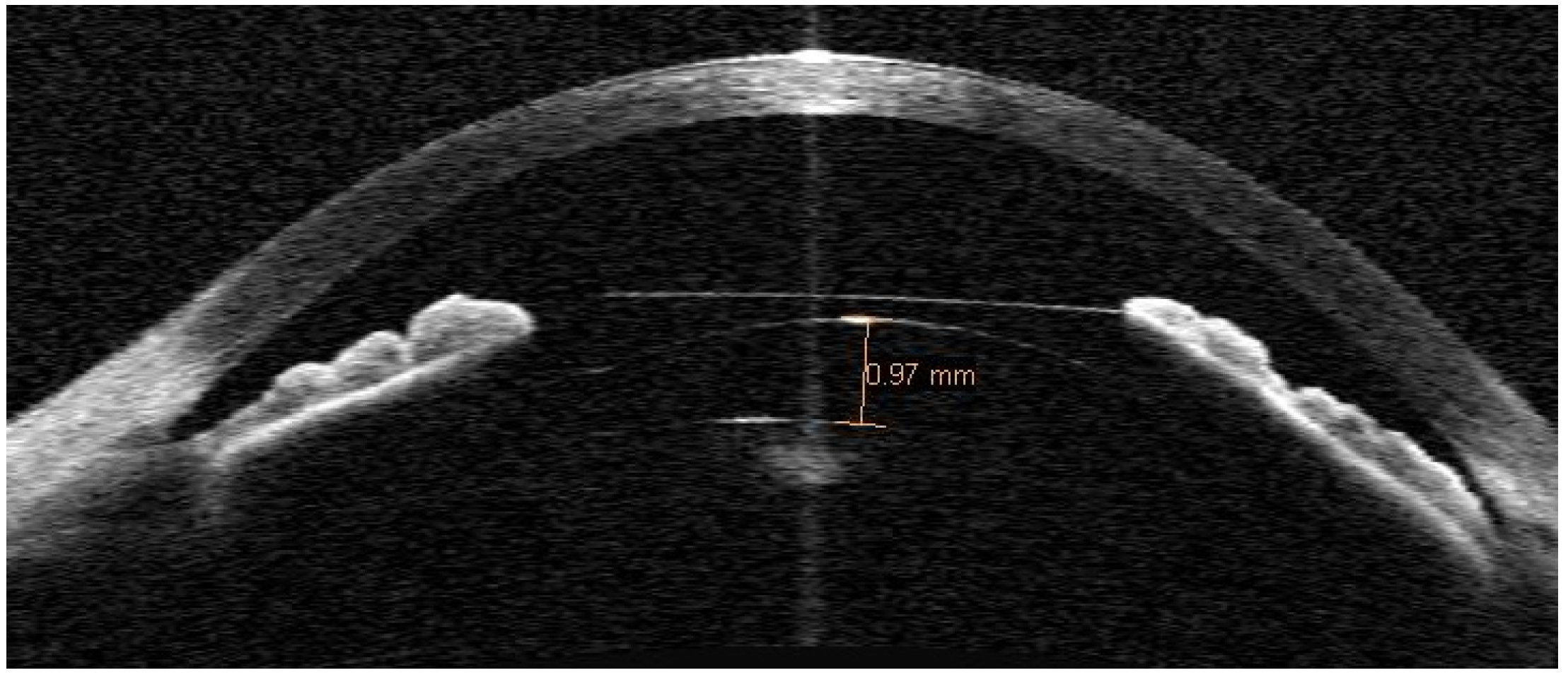 Optics 02 00028 g001