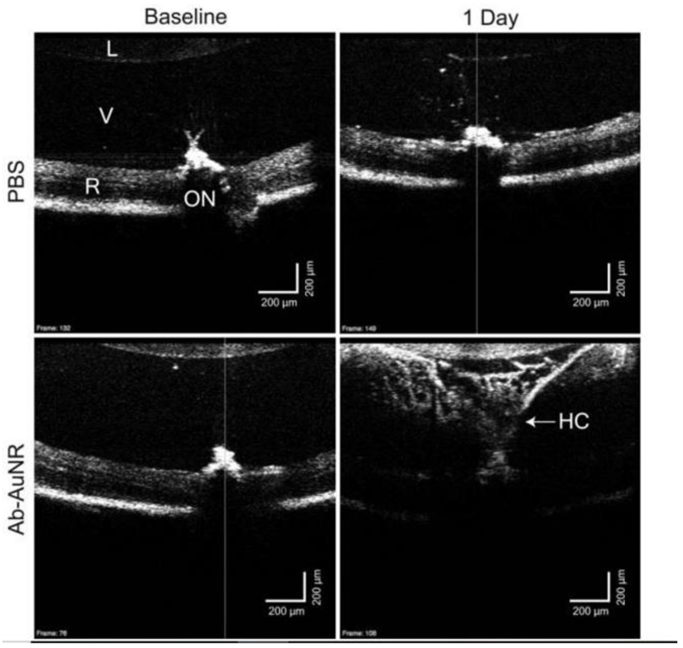 Optics 04 00007 g007 Optics 04 00007 g007