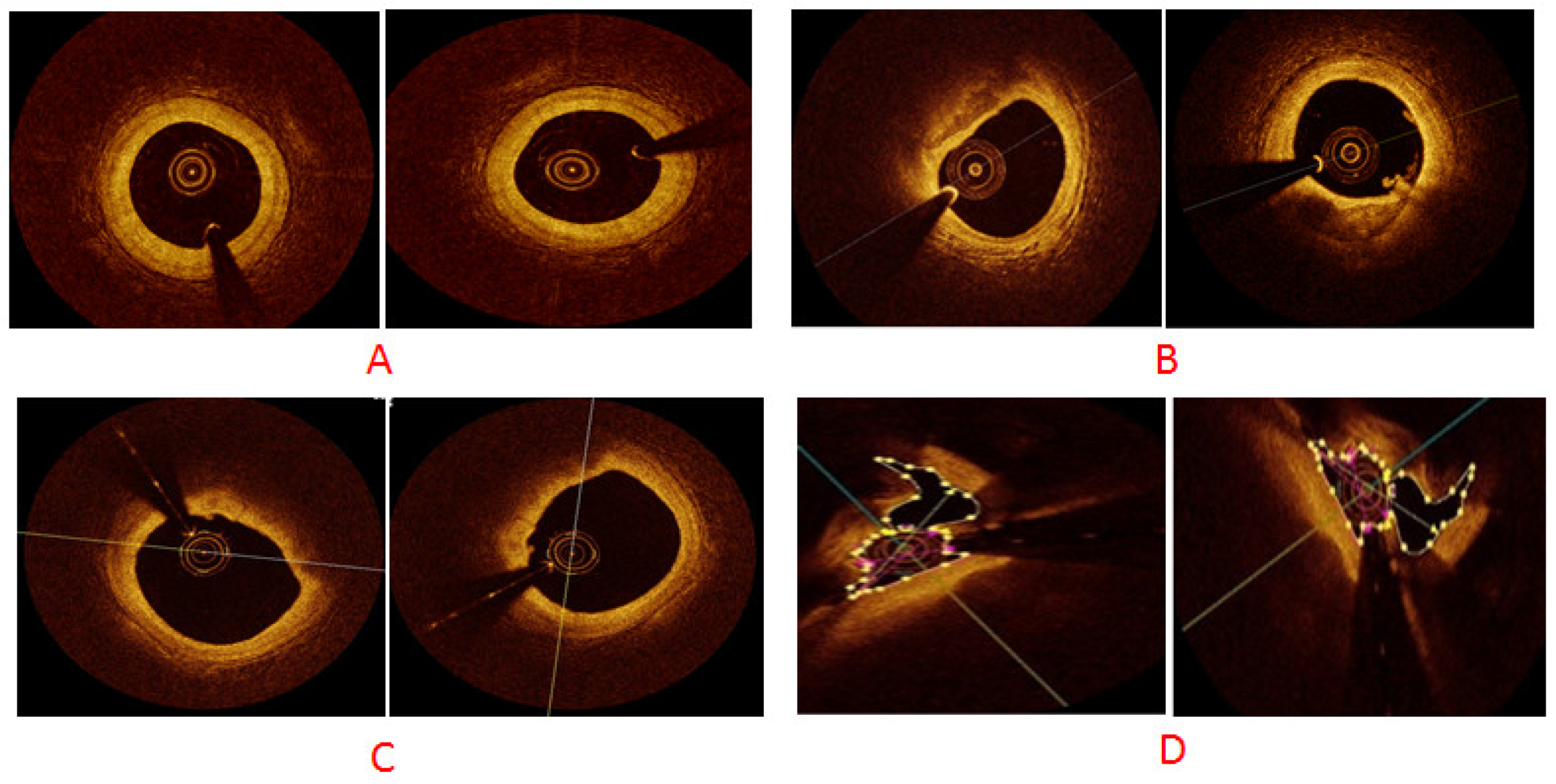 Optics 04 00020 g006 Optics 04 00020 g006