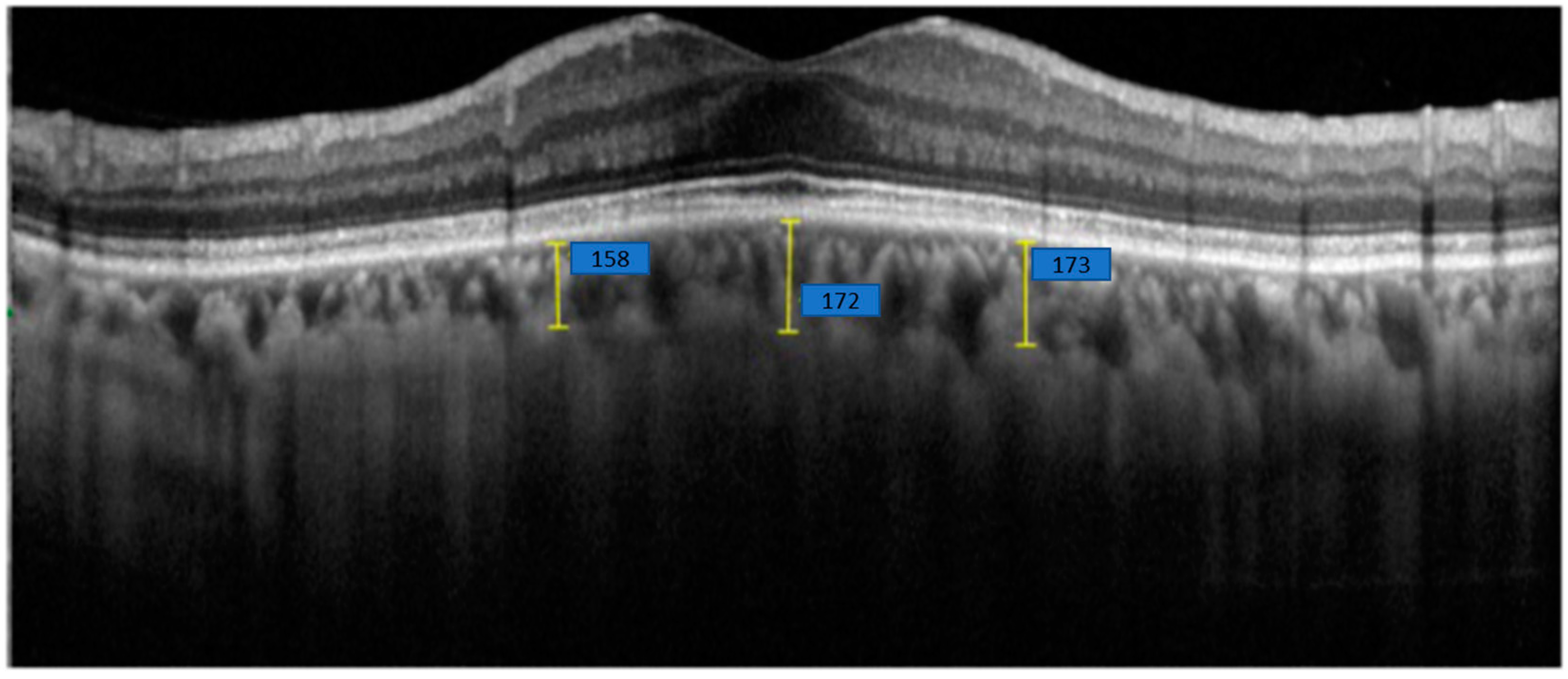 Optics 06 00012 g004