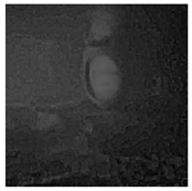 Optics 06 00051 i143