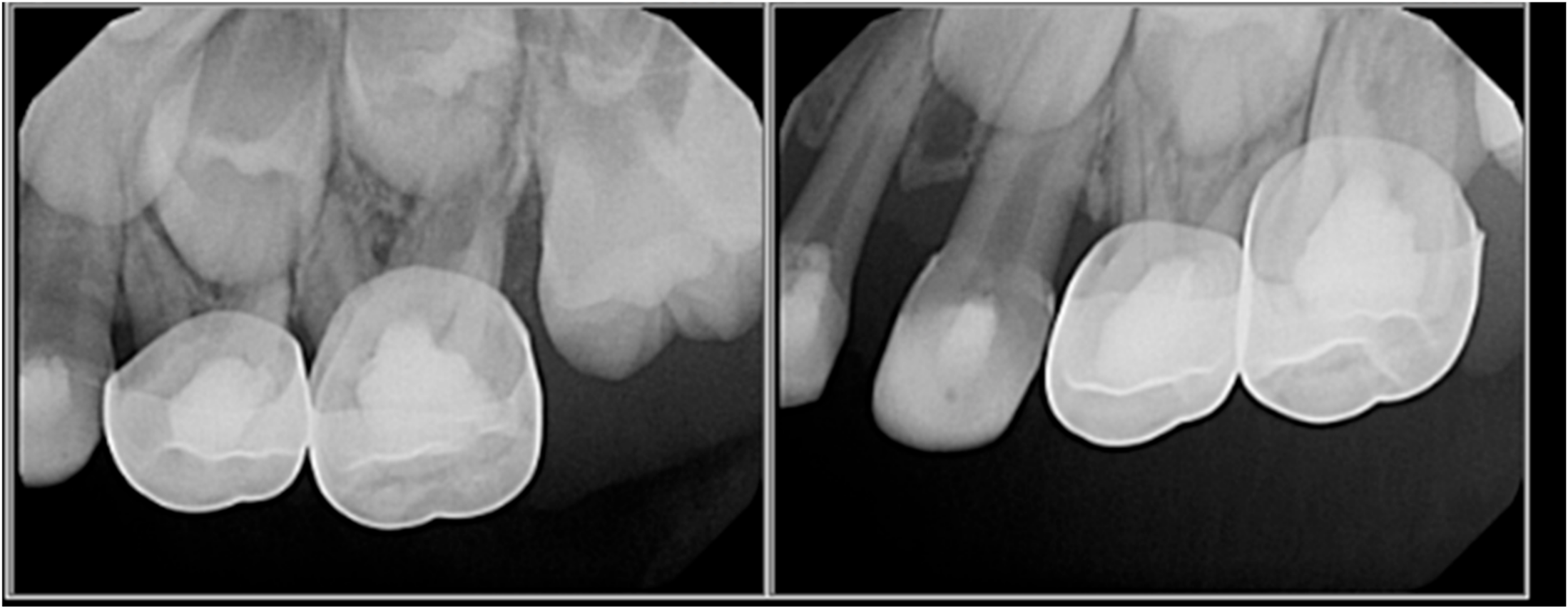 Oral 01 00010 g002 Oral 01 00010 g002