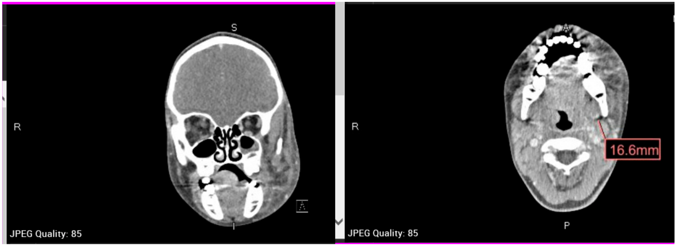 Oral 01 00010 g003 Oral 01 00010 g003