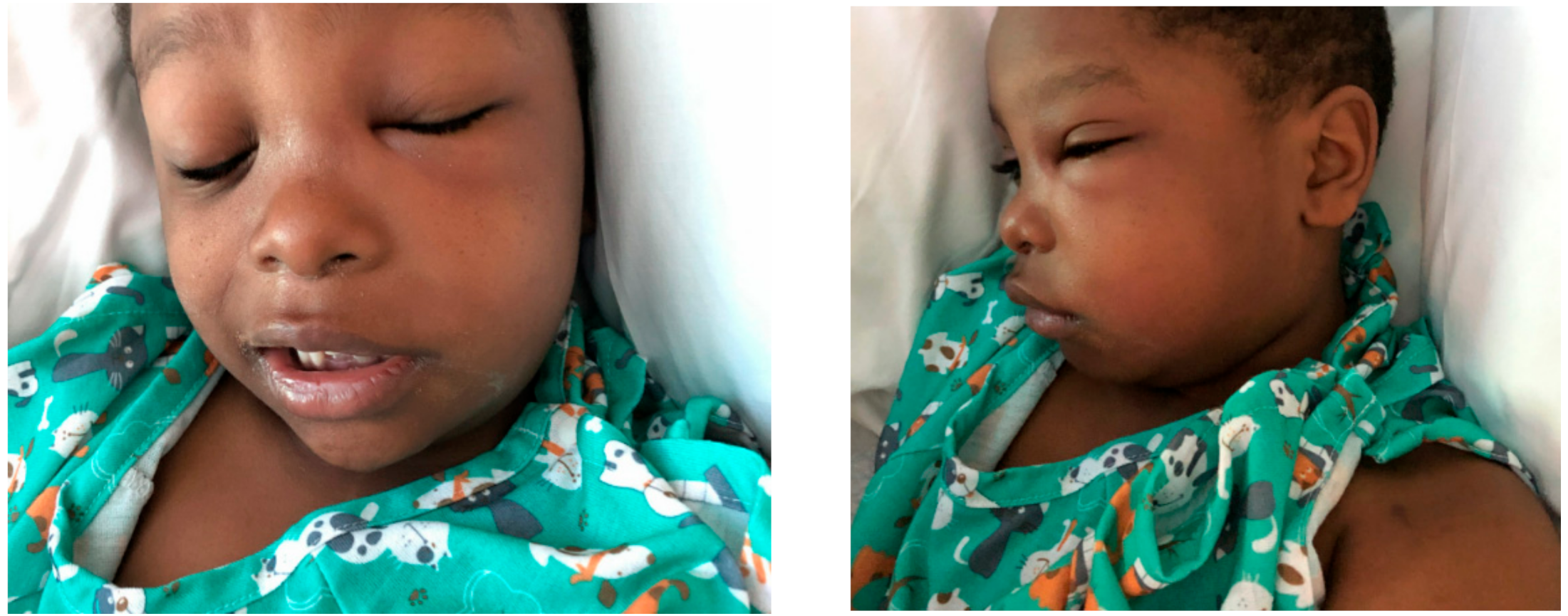 Oral 01 00010 g004 Oral 01 00010 g004