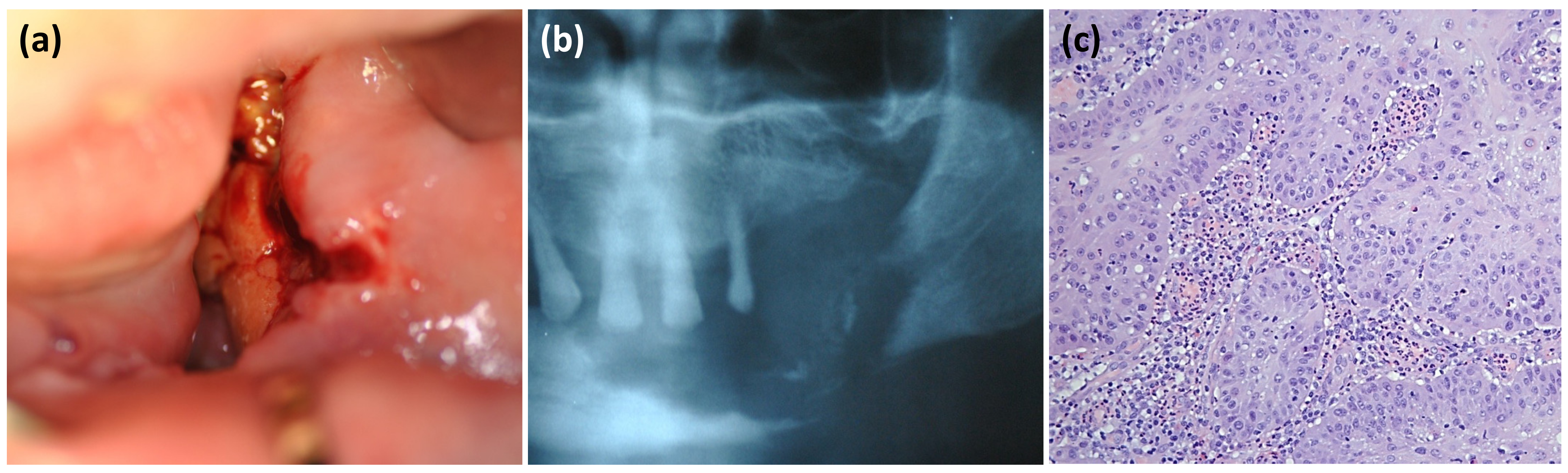 Oral 01 00032 g002 550