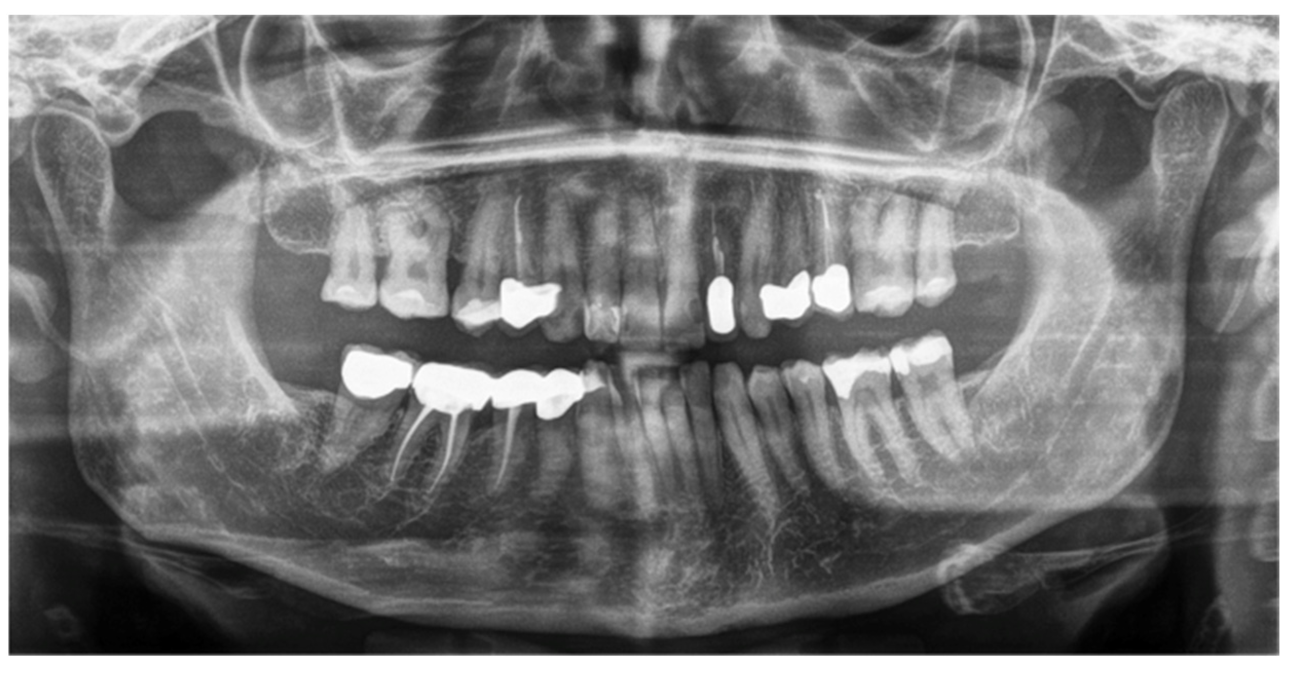 Oral 02 00006 g002 550