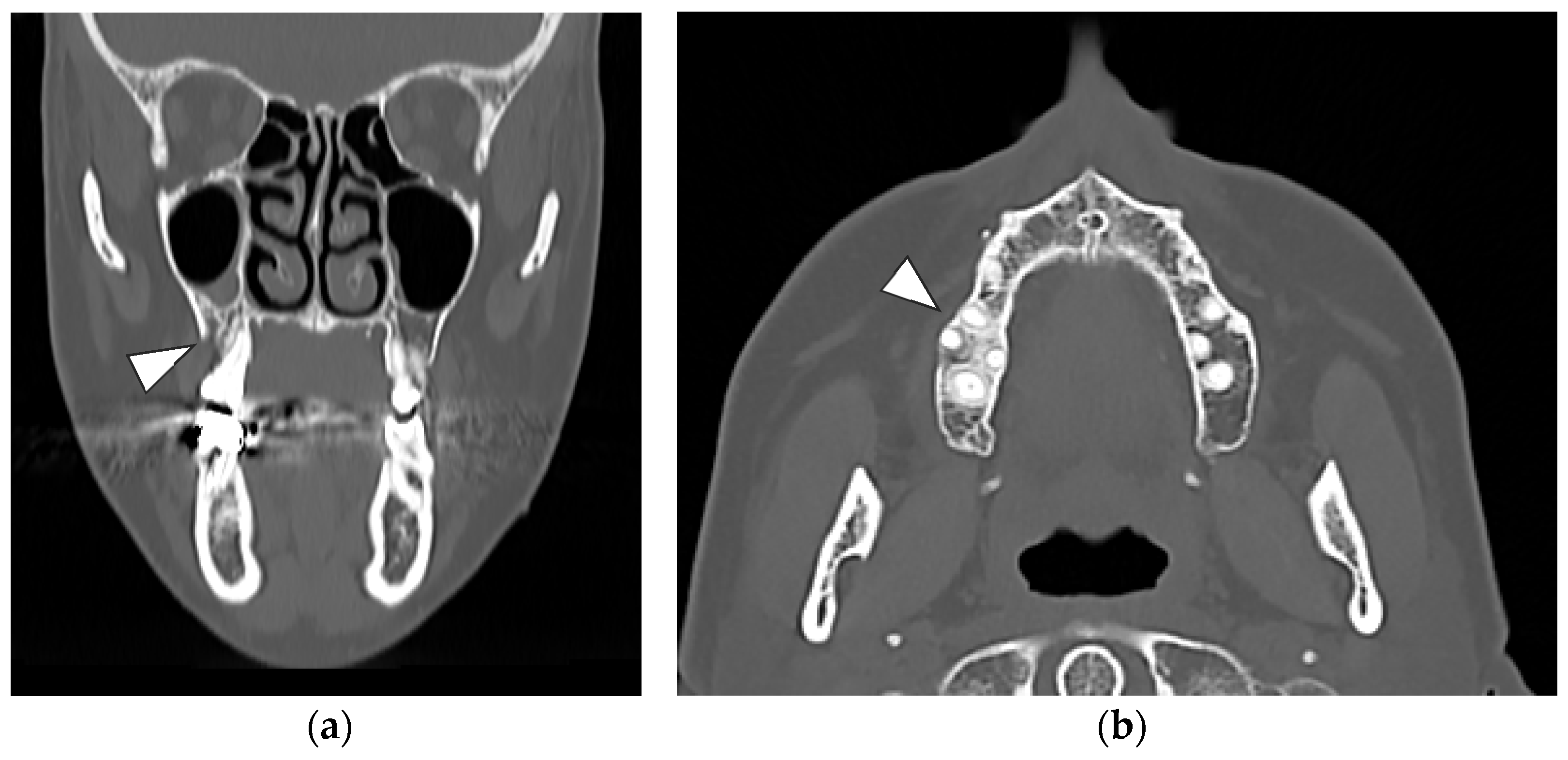 Oral 02 00006 g003 550