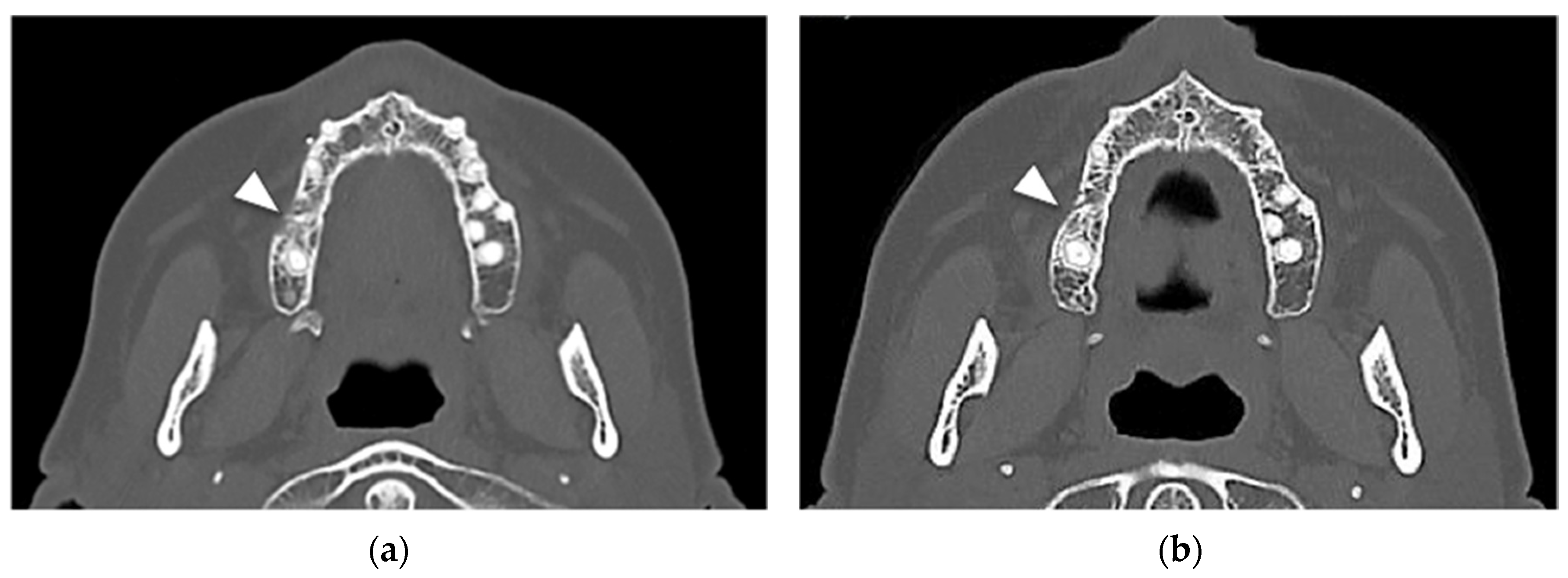 Oral 02 00006 g005 550