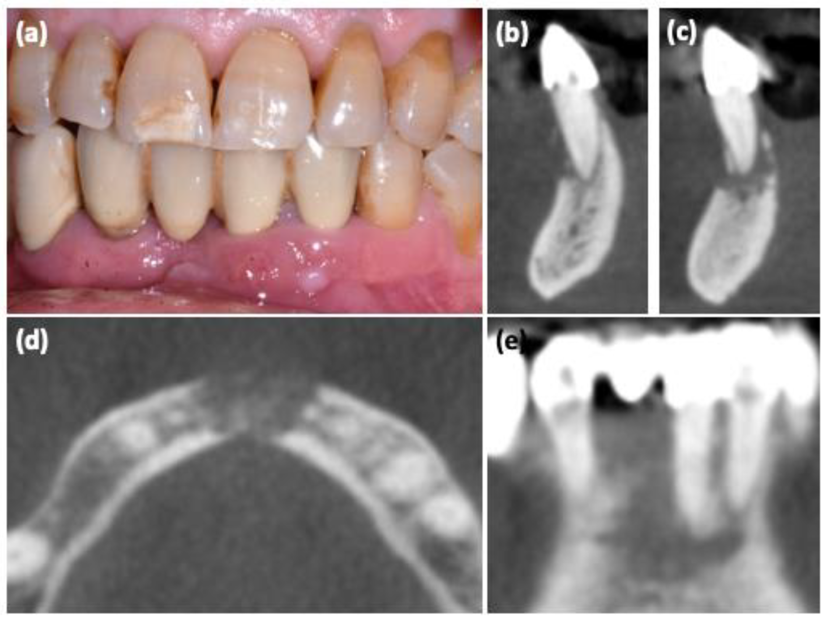 Oral 02 00026 g002 Oral 02 00026 g002