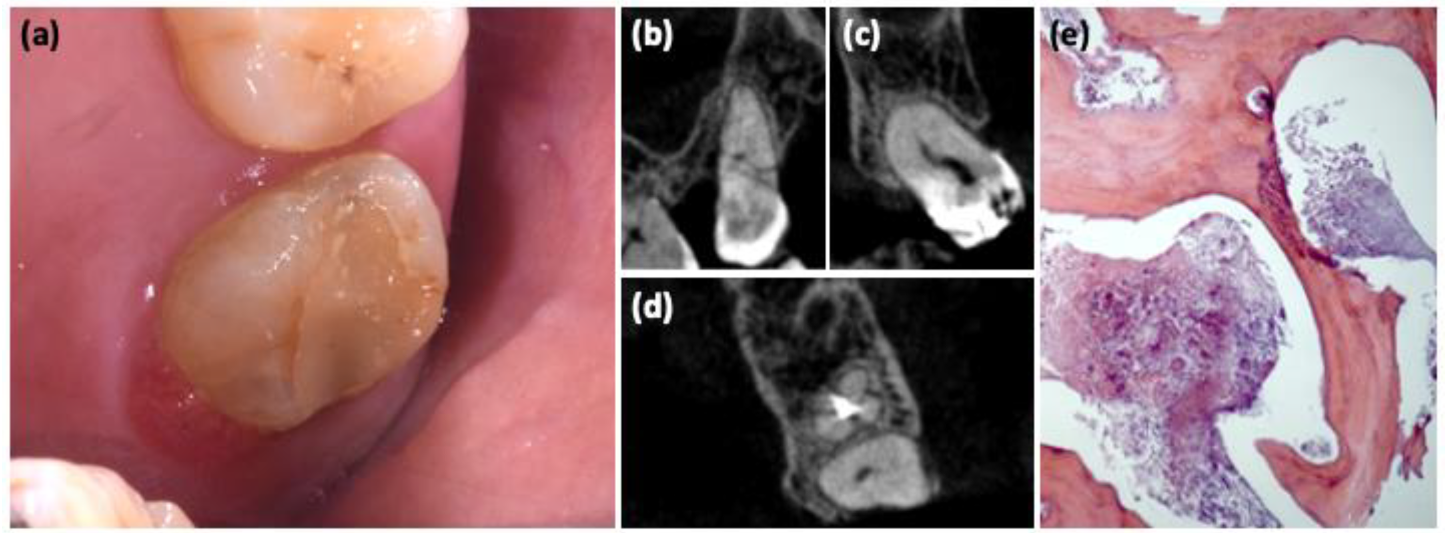 Oral 02 00026 g003 Oral 02 00026 g003