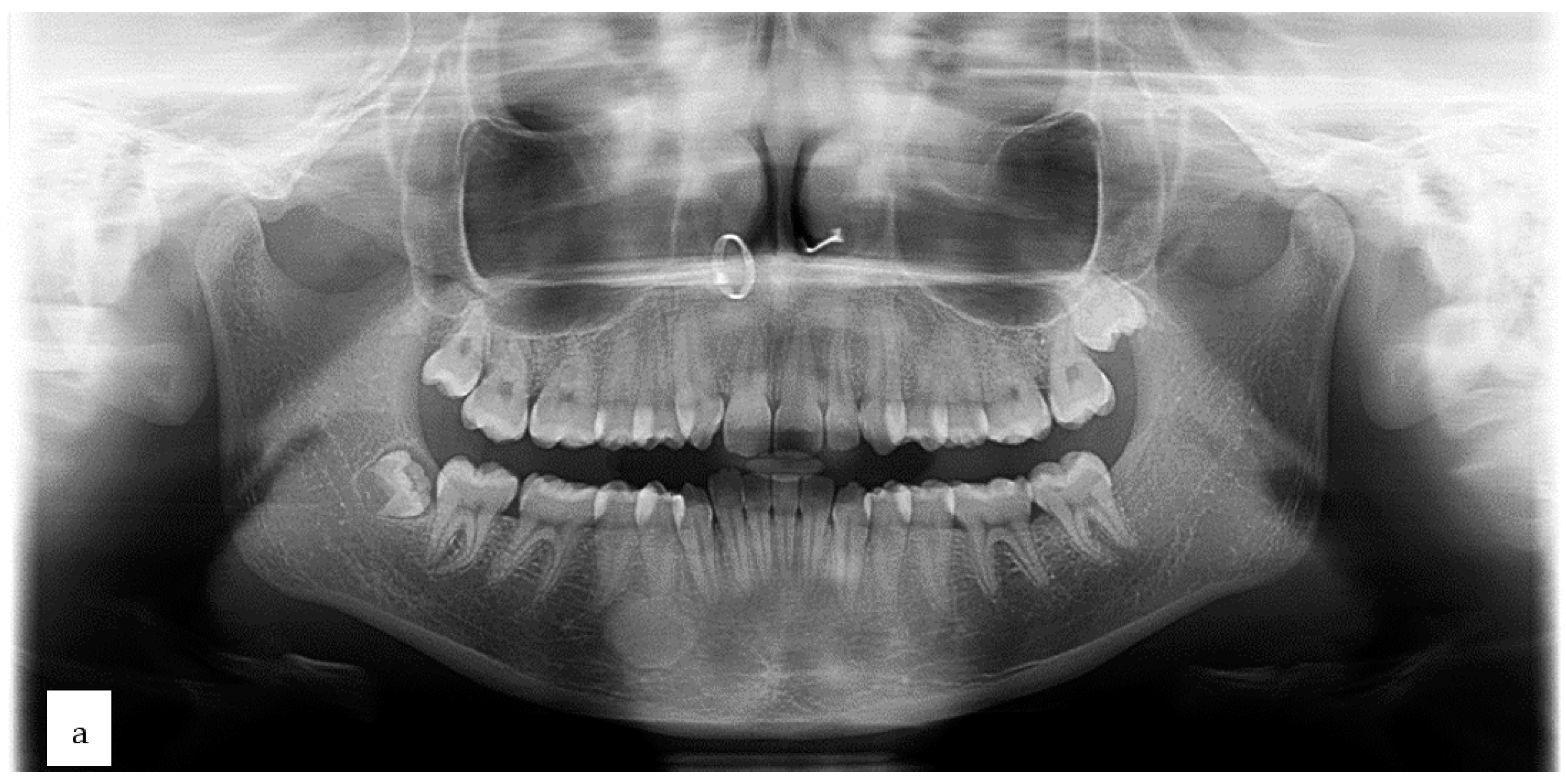 Oral 03 00046 g001a Oral 03 00046 g001a