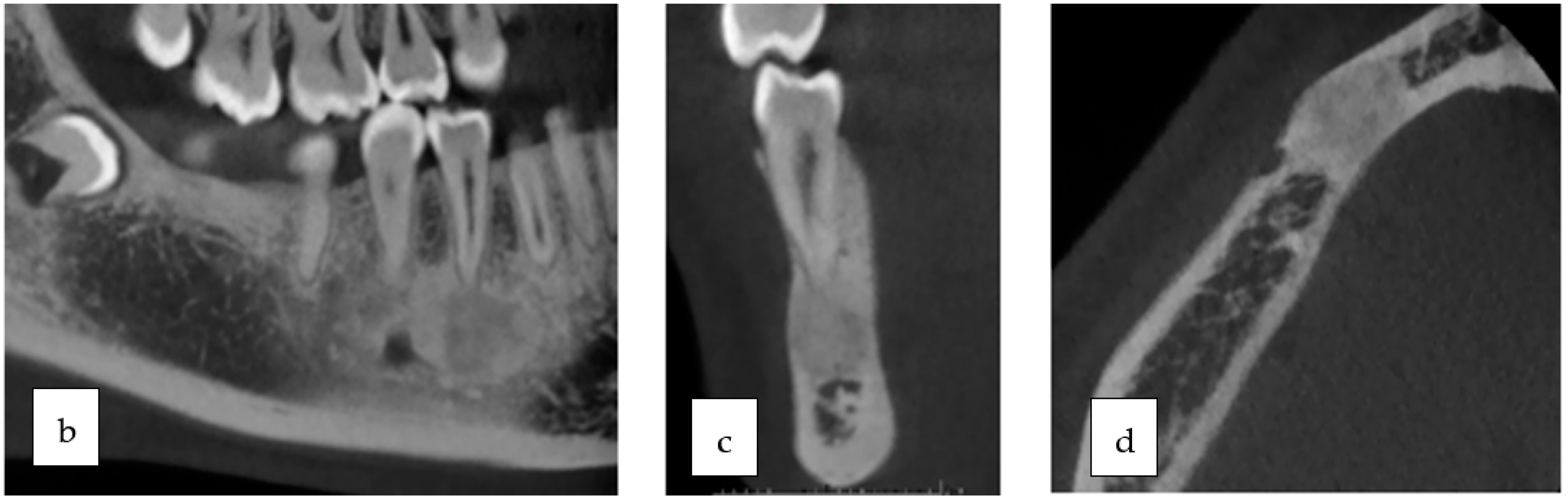 Oral 03 00046 g001b Oral 03 00046 g001b