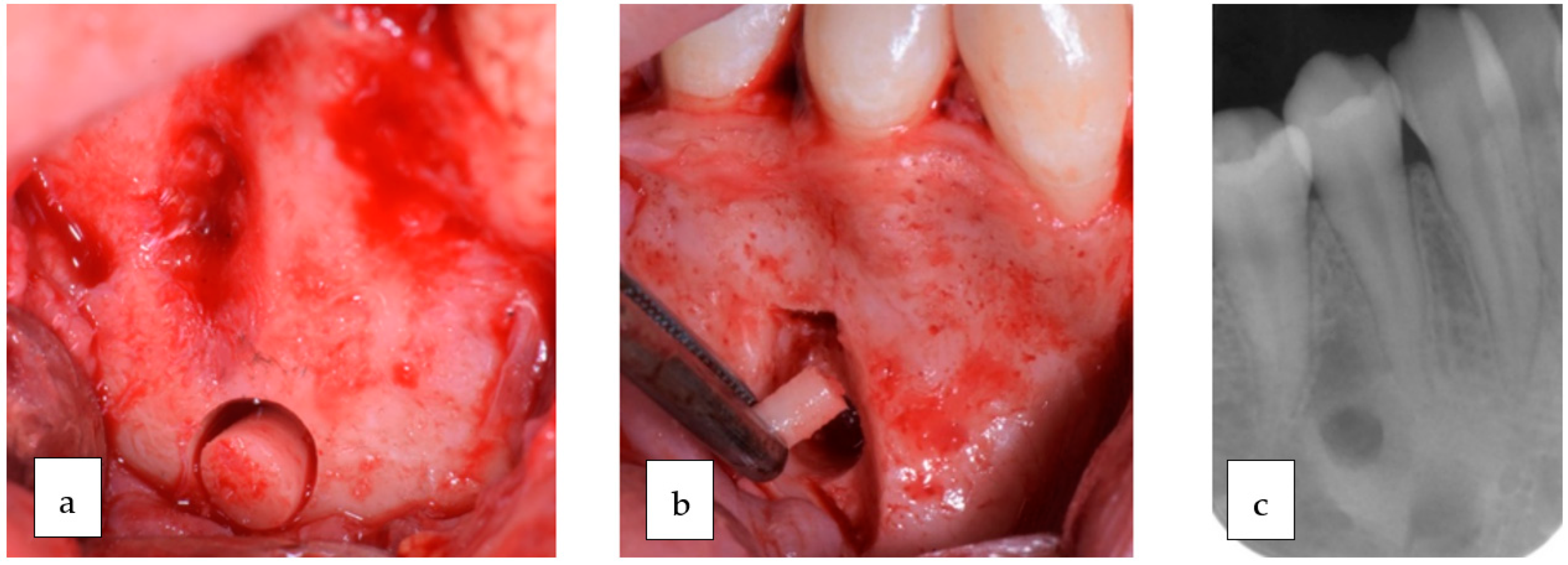 Oral 03 00046 g002 Oral 03 00046 g002