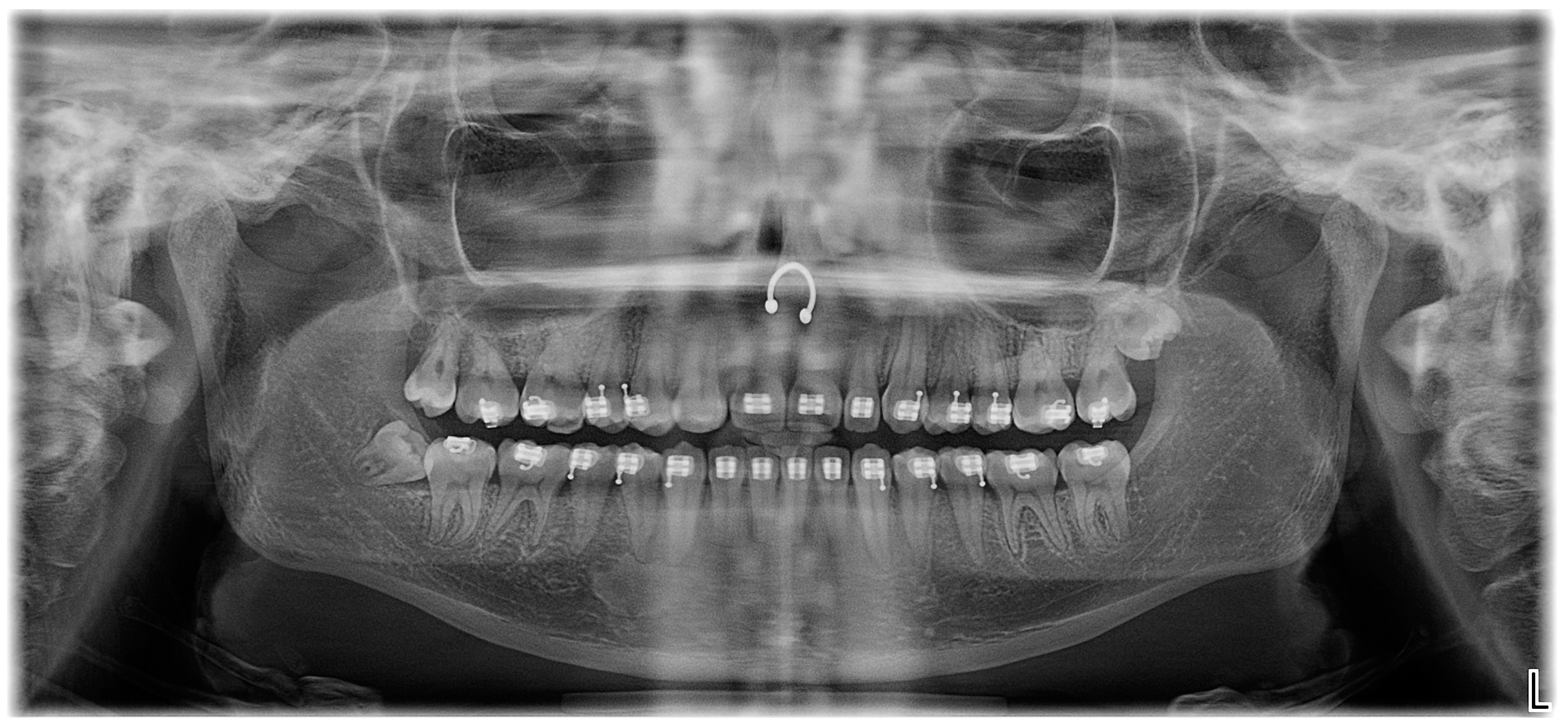 Oral 03 00046 g004 Oral 03 00046 g004