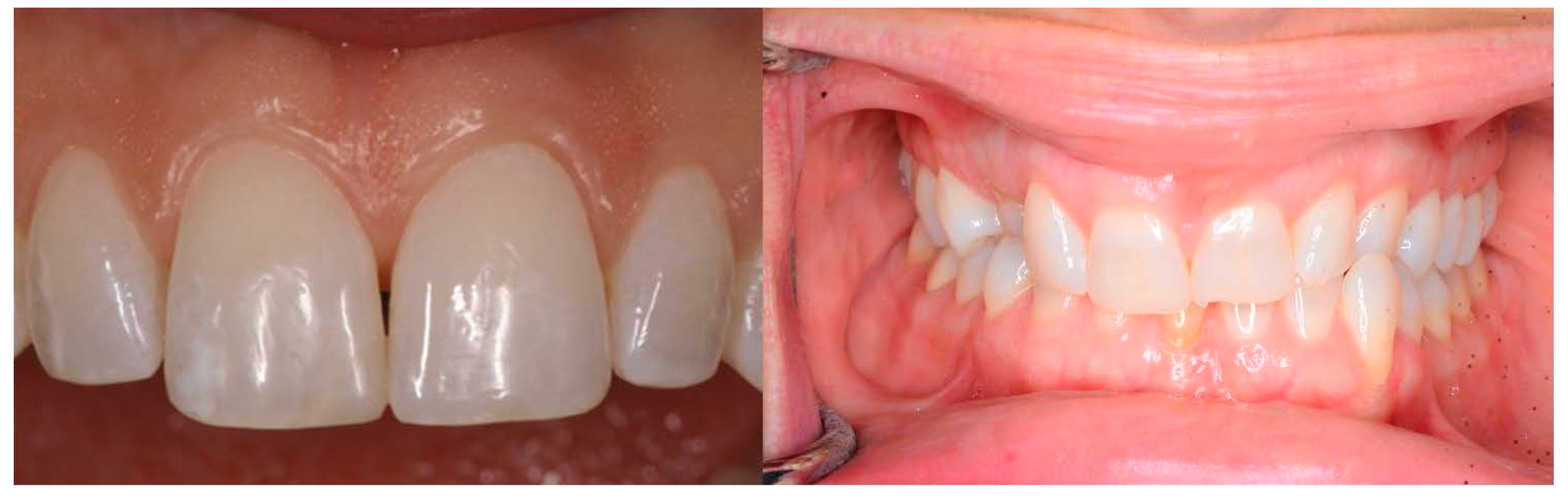 Oral Free FullText The Use of Fine Arts to Enhance Visualization