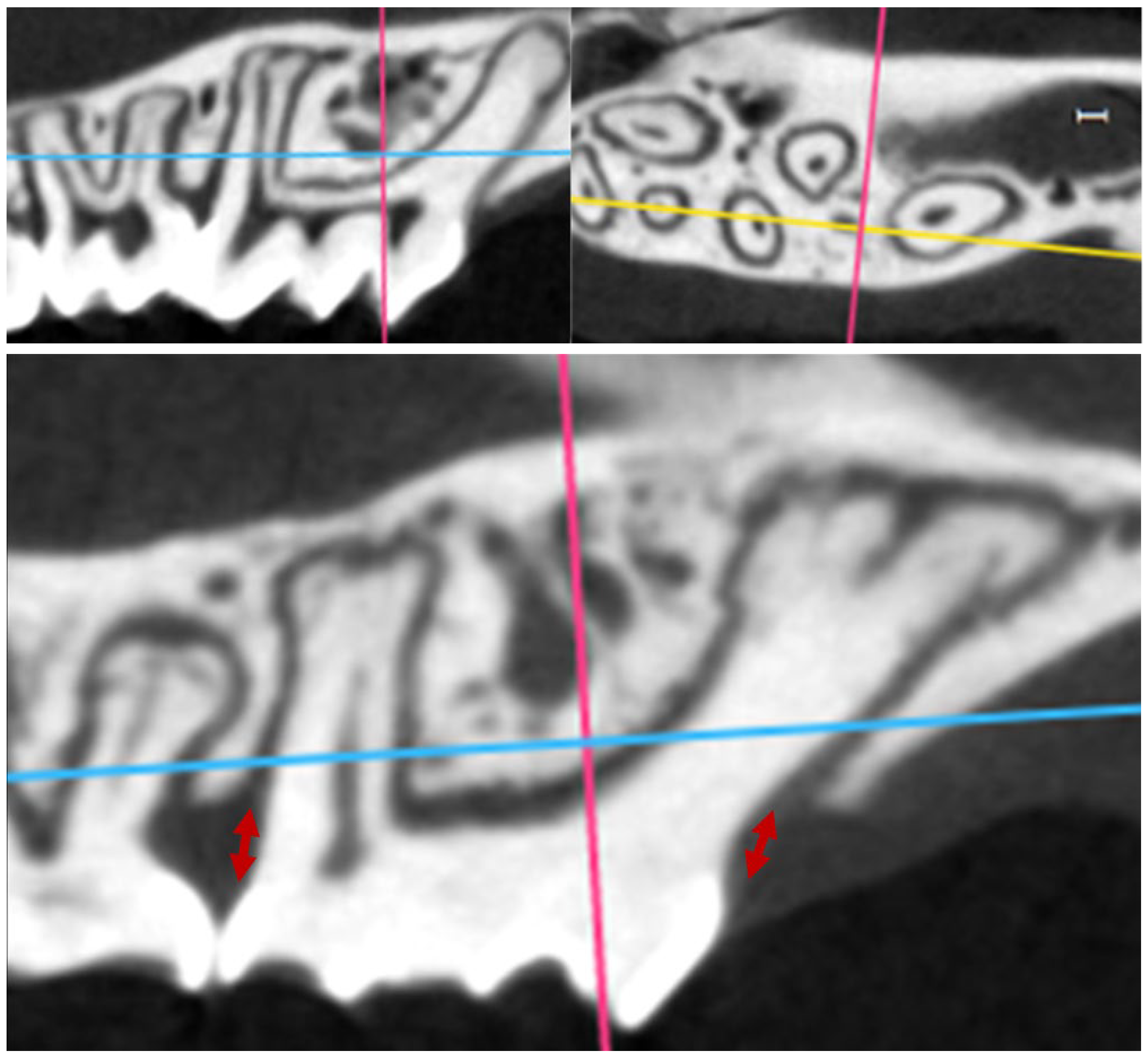 Oral 05 00051 g003 Oral 05 00051 g003