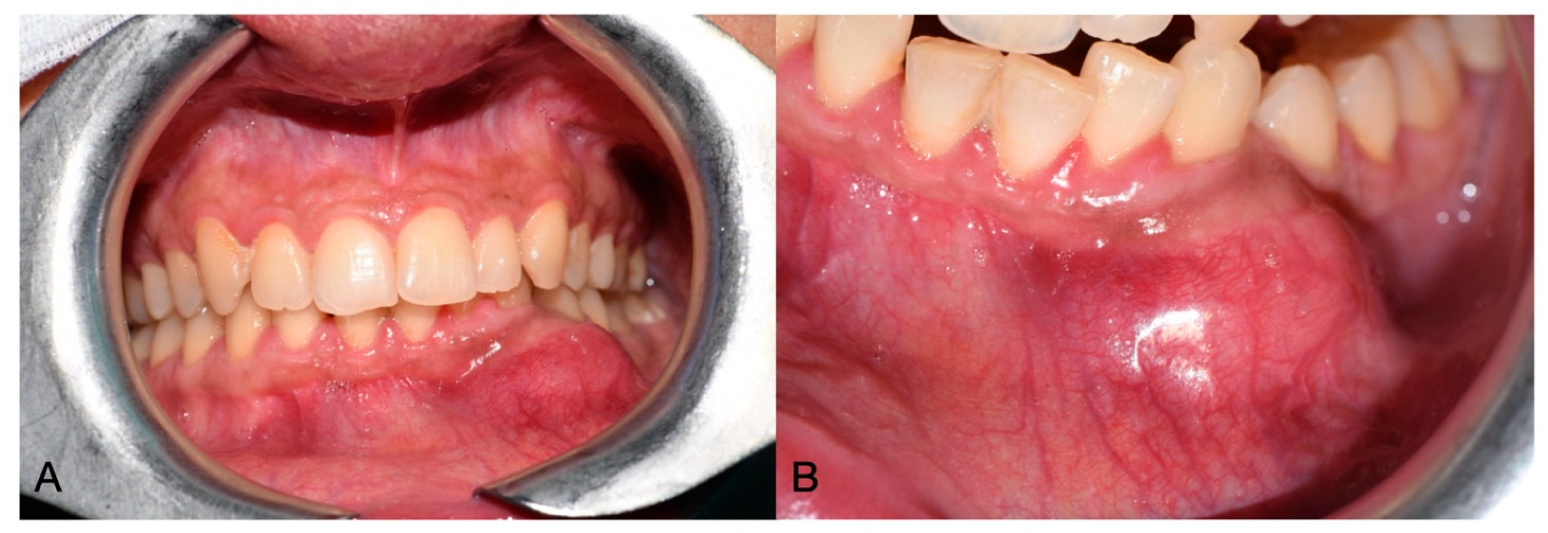 Oral 05 00057 g001 Oral 05 00057 g001