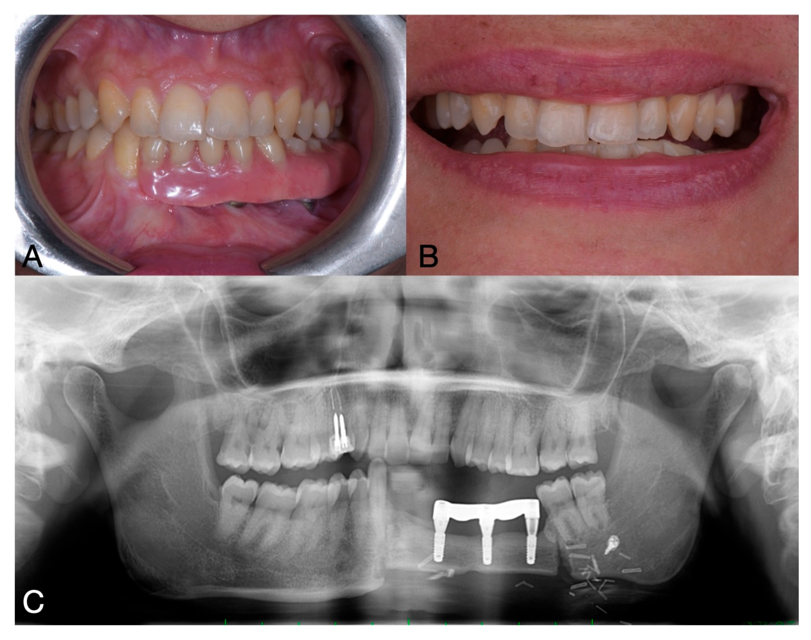 Oral 05 00057 g007 Oral 05 00057 g007